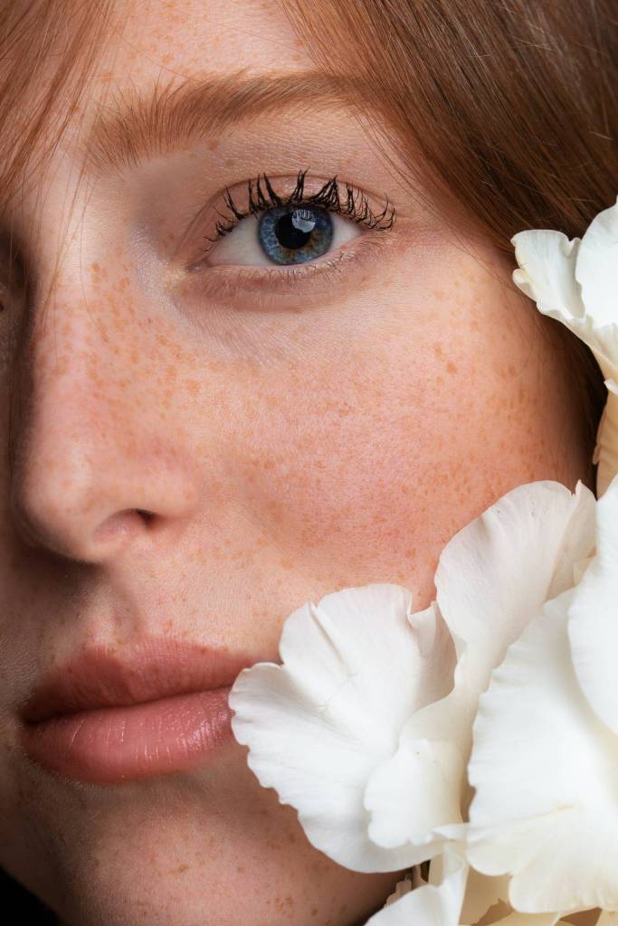 Red Head White Flower Skin A New You Aesthetic Medical Spa Auburn Hills