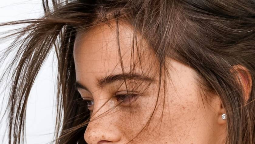 Skin Freckles Hyperpigmentation Medical Spa Aesthetic Oxford