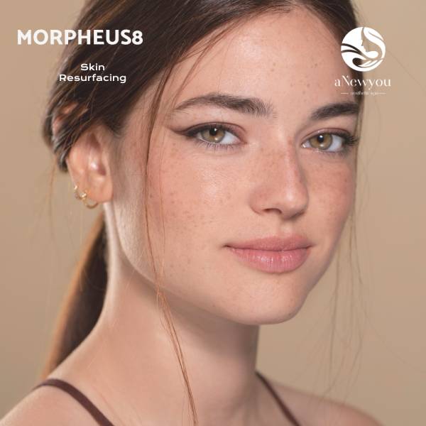 Face Woman Morpheus8 Skin Resurfacing Oxford Mi